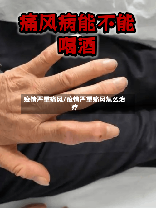 疫情严重痛风/疫情严重痛风怎么治疗-第3张图片